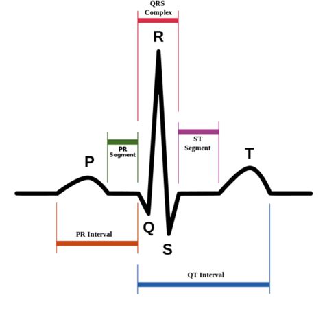 1 06 Analysis Of Ekg Rhythm Strips Cardiac Rhythm Interpretation