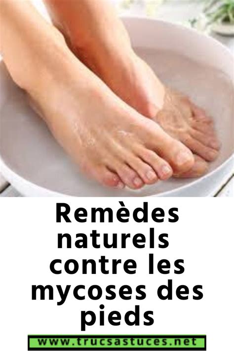 Remèdes Naturels Contre Les Mycoses Des Pieds Mycose Pied Mycose