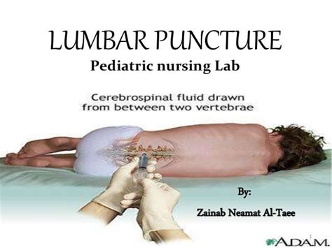 Lumbar Puncture Anatomical Landmarks