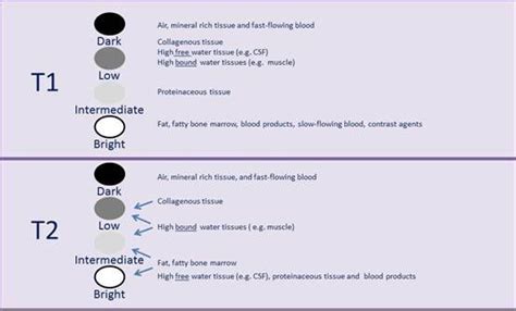 The image contrast depends on therefore, hydrogen atoms in the fat recover more rapidly along the longitudinal axis than csf. Pin on Medicine