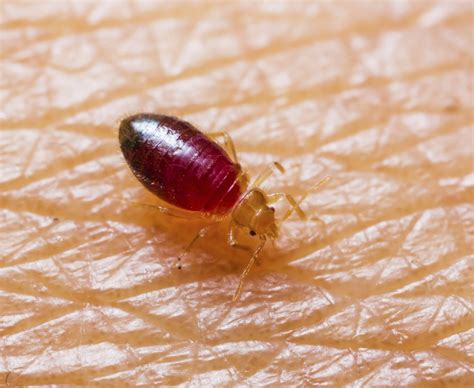 Baby Bedbug Sussex Travel Clinic