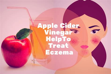 Apple Cider Vinegar For Eczema How To Use It Guide