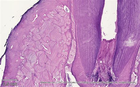 A cross section of a human long bone. Low magnification image of the alveolar bone of the root