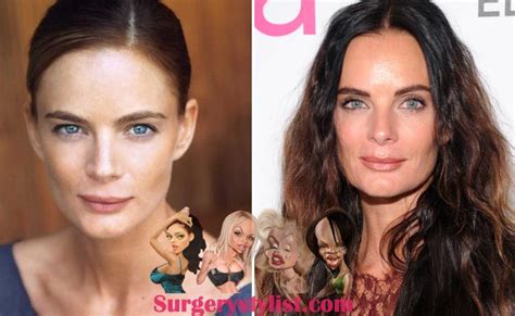 Gabrielle Anwar Plastic Surgery Before And After