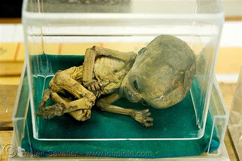 Dead Fetus Mummified ศพเด็ก Forensic Medicine Museum