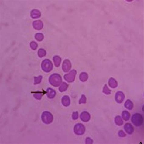 Biochemical Findings In Healthy And Babesiosis Affected Cows Mean±sd