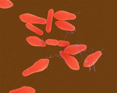 Clostridium Botulinum Photograph By Dennis Kunkel Microscopyscience