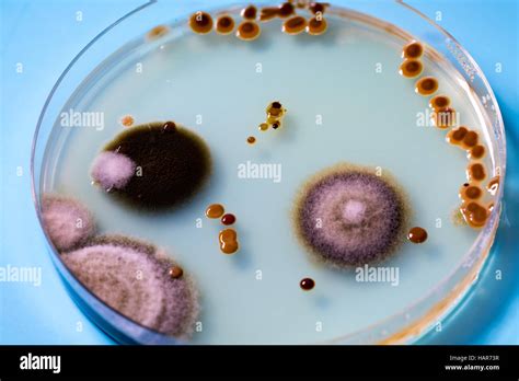 Bacteria Colonies On Petri Dishes Stock Photo Alamy