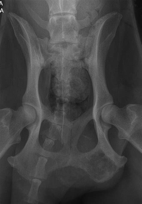 Bone Tumors Pelvic — Dr Julius M Liptak