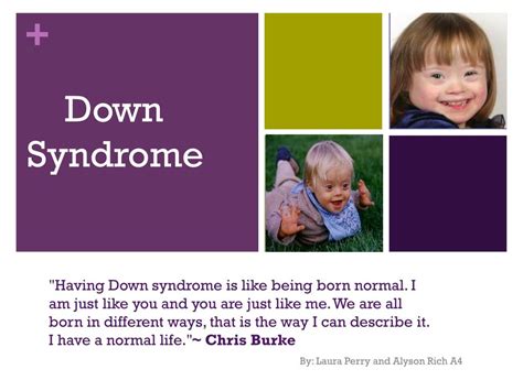 Ppt Down Syndrome Powerpoint Presentation Free Download Id4397584