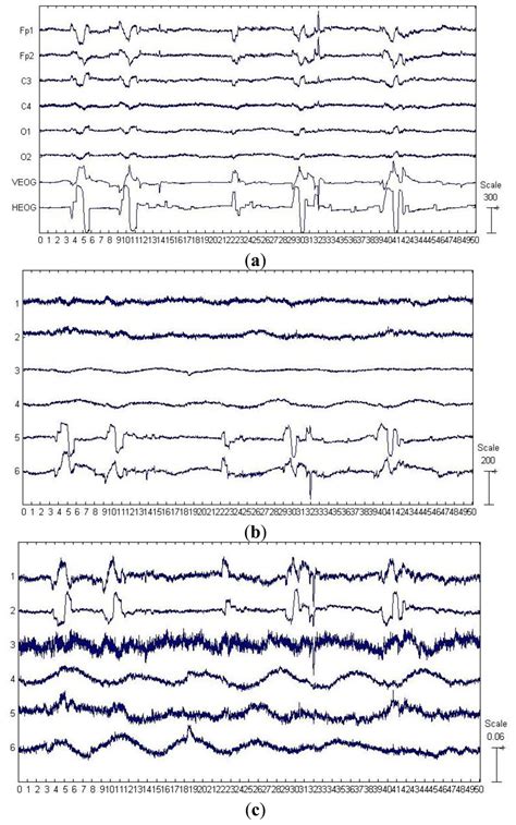 Sensors | Free Full-Text | EOG Artifact Correction from ...