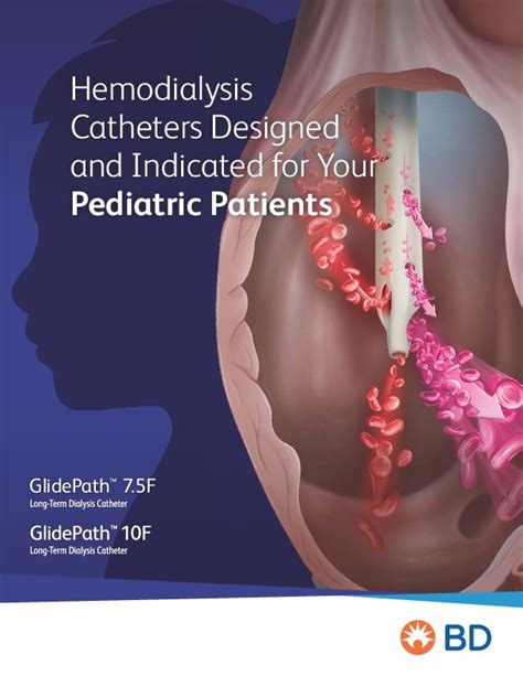 glidepath™ 7 5f 10f long term hemodialysis catheter bd