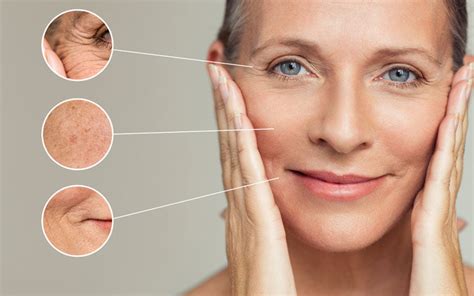 How To Reduce Wrinkles On The Face Skinkraft