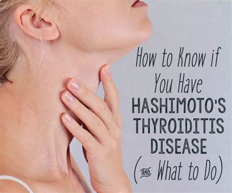 How To Know If You Have Hashimotos Disease And What To Do With Images