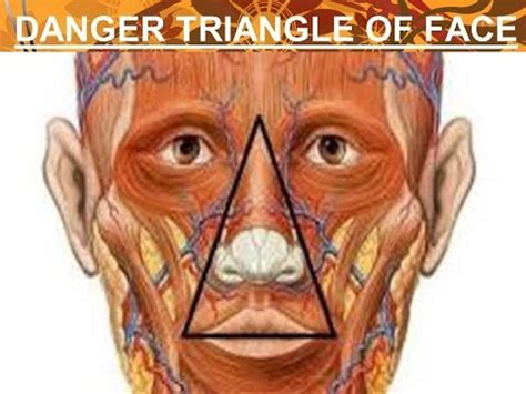 This area has been so named because boils, infections of the nose and injuries around the nose, especially those that become infected can readily spread to cavernous sinus resulting in cavernous sinus thrombosis (cst). DANGER TRIANGLE OF FACE DR. FOHEID ALSOBEI - YouTube