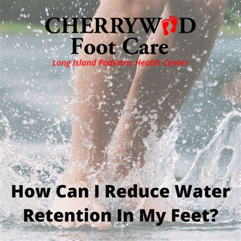How Can I Reduce Water Retention In My Feet Cherrywood Foot Care