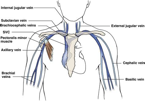 Upper Extremity Venous Doppler Ultrasound Radiologic Clinics