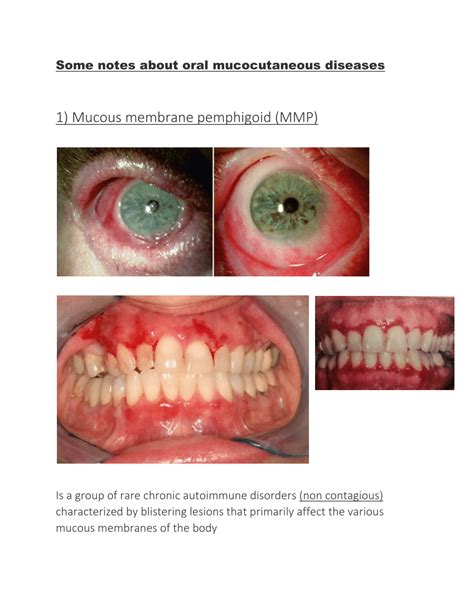 Pdf Literature Review Oral Mucocutaneous Diseases
