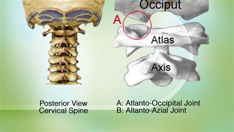 Atlanto Occipital Joint Atloido Occipital Joint