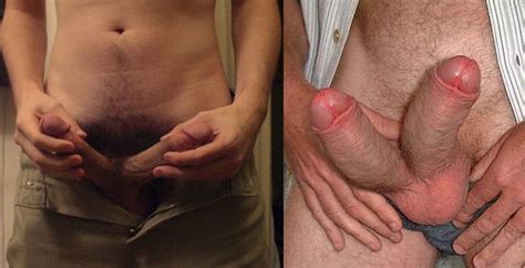 Man With Two Penises Pics Xhamster