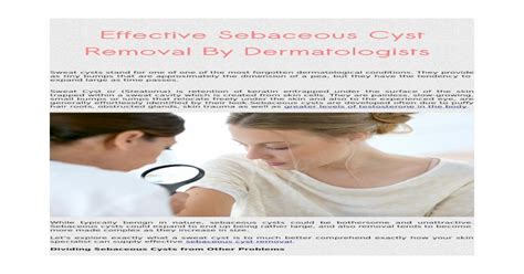 Download Pdf Effective Sebaceous Cyst Removal By Dermatologists