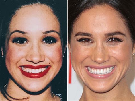 Meghan Markle Before And After From 1990s To 2020 The Skincare Edit