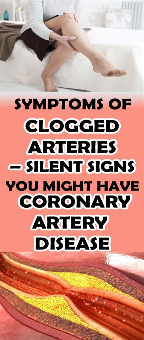 Symptoms Clogged Arteries Signs Coronary Coronary Artery Disease