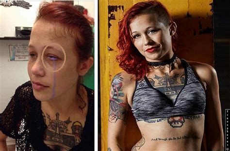 Catt Gallinger In Danger Of Blindness After Her Eyeball Tattoo Work