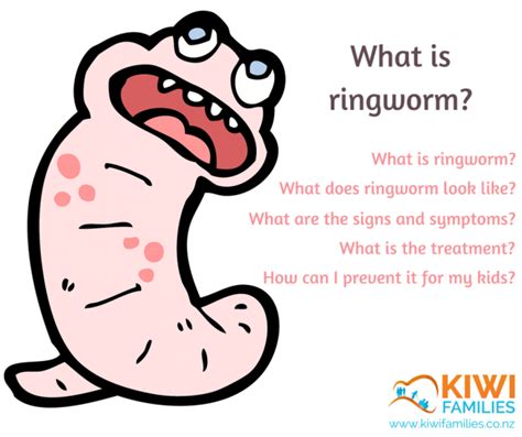 How To Treat Ringworm In Kids Kiwi Families
