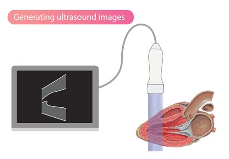 Technical Aspects Of The Ultrasound Image Ecg And Echo