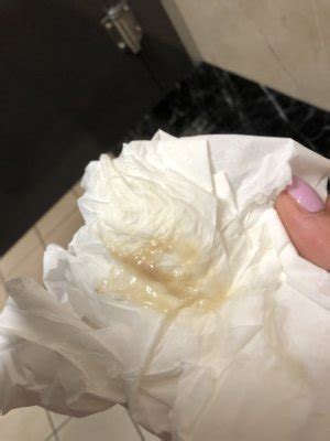 Might be some mucus : Brown discharge or plug? TMI PICTURE - March 2018 - BabyCenter Australia