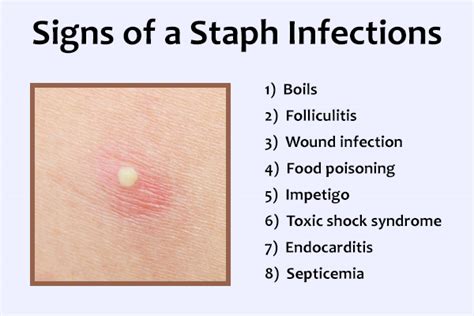 Staph Infection Symptoms Treatment And Preventive Tips