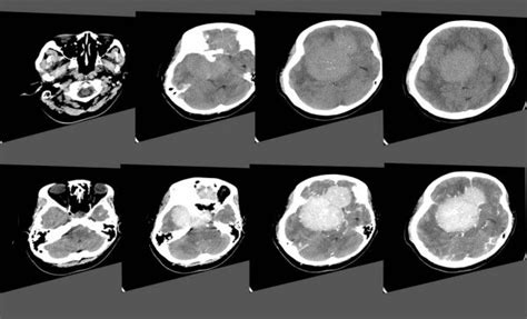 Ct Scans Stock Photos And Royalty Free Images Depositphotos
