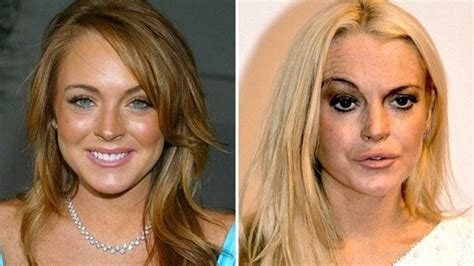 Celebrities Who Have Aged The Worst Celebrities Then And Now Vrogue