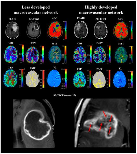 Cancers Free Full Text Macrovascular Networks On Contrast Enhanced