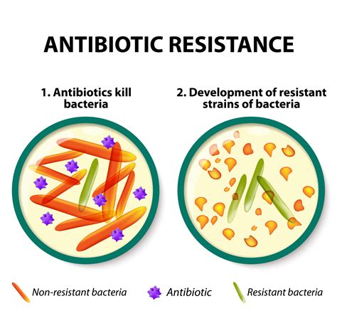 Antibiotic Resistance In Canada The Canadian Encyclopedia