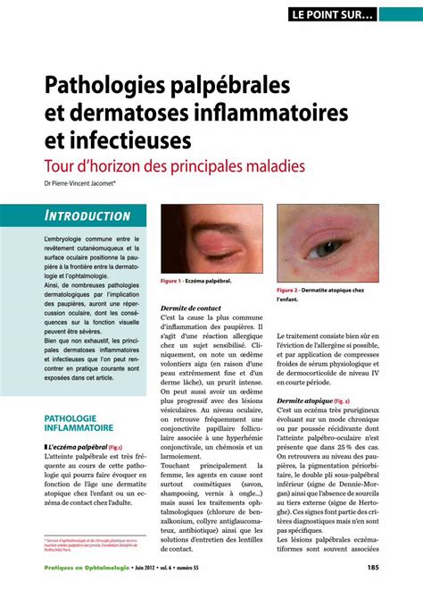 Pdf Pathologies Palpébrales Et Dermatoses Inflammatoires Et · Le