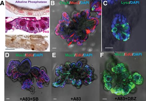 Long Term Expansion Of Epithelial Organoids From Human Colon Adenoma