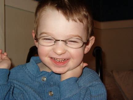 Angelman Syndrome Pictures Symptoms Causes Treatment Life