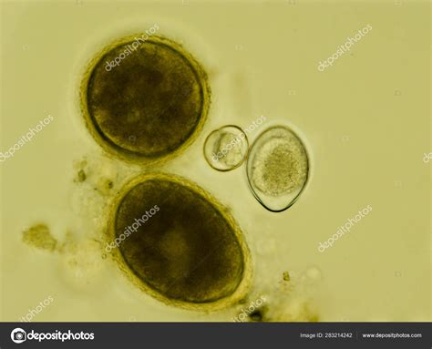 Toxocara Canis Egg