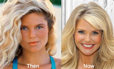 Christie Brinkley Plastic Surgery Breast Implants Botox Injections