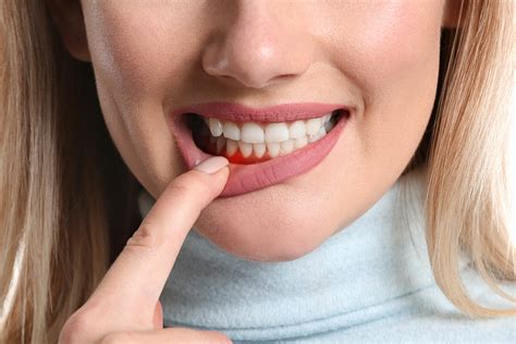 Treatment For Gum Infections And Inflammation West Houston