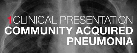 Community Acquired Pneumonia Clinical Presentation Pemblog