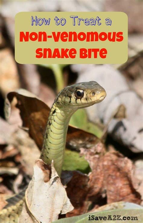 How To Treat A Snake Bite Top 5 Most Venomous Snakes