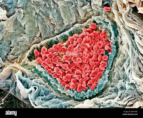 Red Blood Cells Coloured Scanning Electron Micrograph Sem Of Human Red Blood Cells