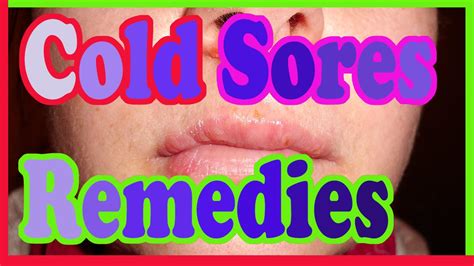 Dr Oz Fast Cold Sores Remedies How To Heal Cold Sores Youtube