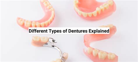 Different Types Of Dentures Explained Cost Pros And Cons