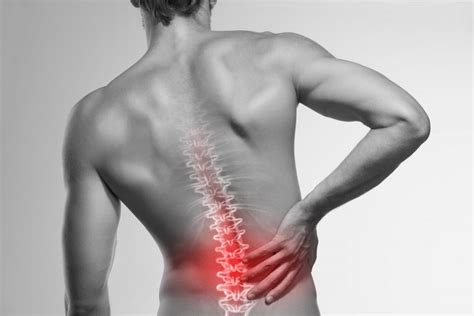 Pinched Nerve In San Leandro And Dublin Ca Spine And Sportcare