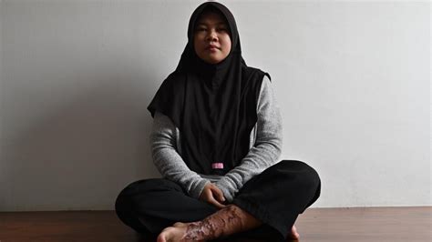 Indonesian Maid’s Torture Highlights Lack Of Legal Protections Dnyuz