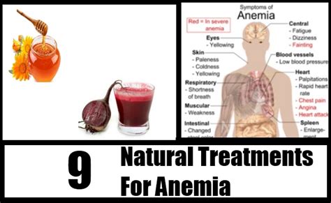 8 Natural Treatments For Anemia How To Treat Anemia Naturally